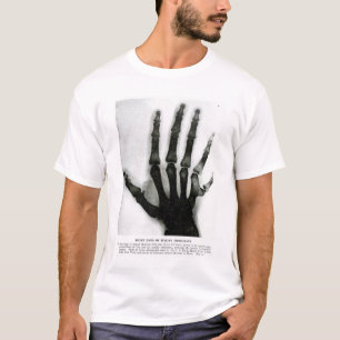 Röntgenhandje met extra vingers Shirt