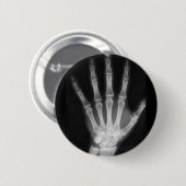 Röntgenplaat B&W Ronde Button 5,7 Cm (Voorkant /achterkant)