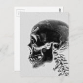 Röntgenschedel Briefkaart (Voorkant / Achterkant)