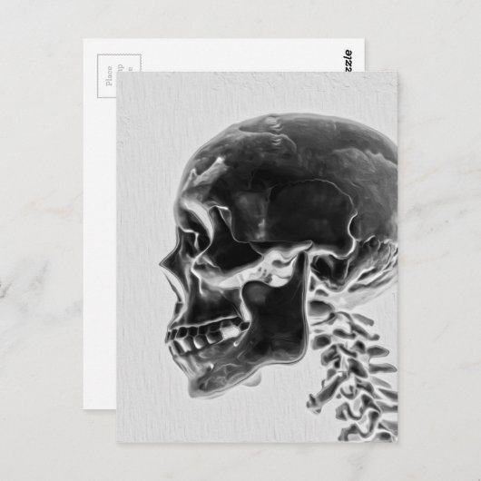 Röntgenschedel Briefkaart (Voorkant / Achterkant)