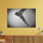 röntgenUitzicht van menselijke voet 4 Canvas Afdruk (Insitu (Woonkamer))
