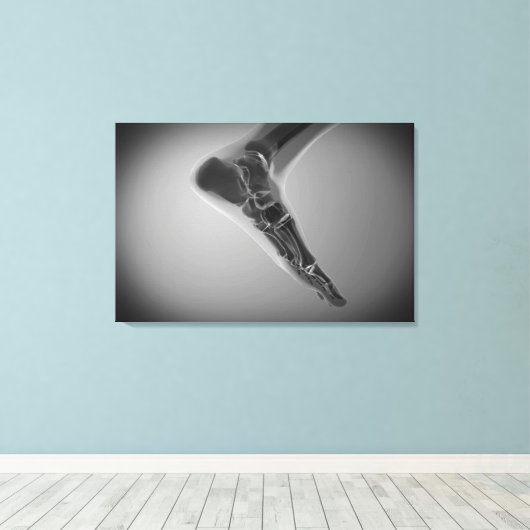 röntgenUitzicht van menselijke voet 4 Canvas Afdruk (Insitu (Houten vloer))