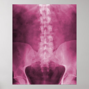 Roze digitale röntgenfoto's poster