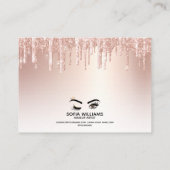 Roze mooie bruine ogen met gouden kroonnazorg aanbevelingskaartje (Achterkant)