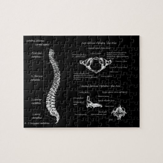 Rug Legpuzzel (Horizontaal)