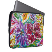 Sac électronique supérieur (Devant droit)