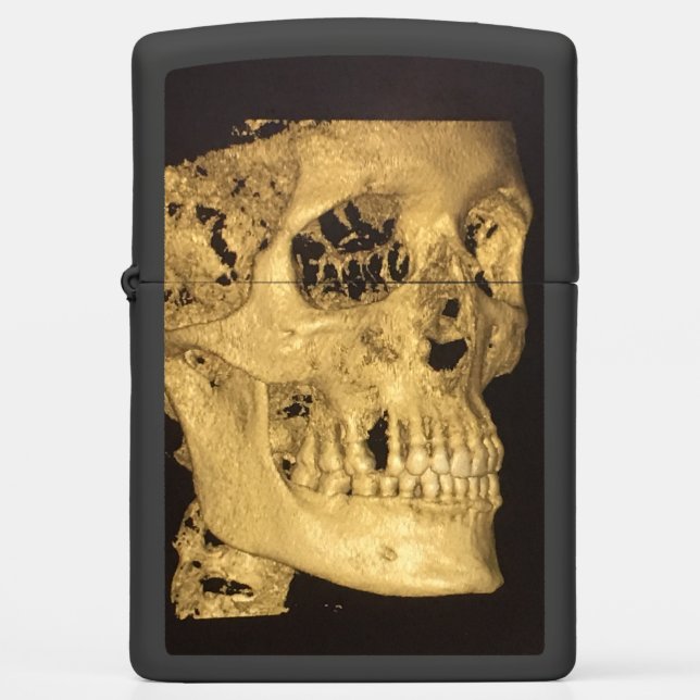 Scale schedel (Voorkant)