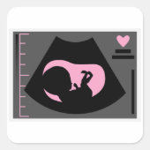 Schattigee Ultrasound Planner Stickers voor IVF/IU (Voorkant)