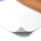 Schema van de voornaamste symptomen van diabetes b poster (Hoek)