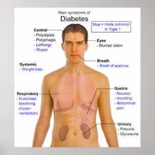 Schema van de voornaamste symptomen van diabetes b poster