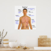 Schema van de voornaamste symptomen van diabetes b poster (Keuken)