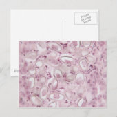 Science Parasite Briefkaart (Voorkant / Achterkant)