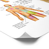 Sclerotome Visceral Pain Poster de référence (Coin)