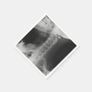 Serviette En Papier 2 radiographiés (original)