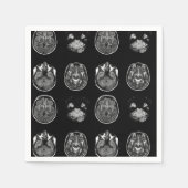Serviette En Papier Analyse IRM du cerveau (Devant)