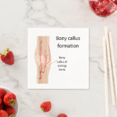 Serviette En Papier Formation de cales de Bony (En situation)