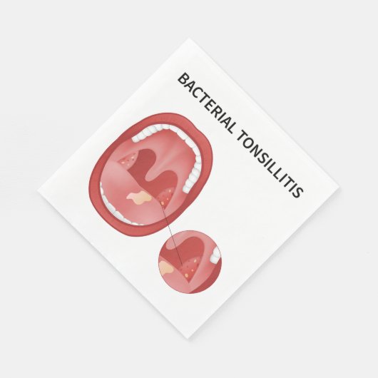 Serviette En Papier Ttonsillite bactérienne (Coin)