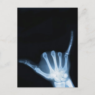 Shaka Sign X-Ray (Hang los) Briefkaart