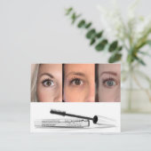 Shaklee Youth Mascara Briefkaart (Staand voorkant)