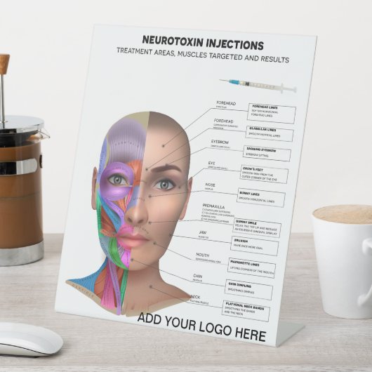 Signe De Table Points d'injection de neurotoxine (In SItu)