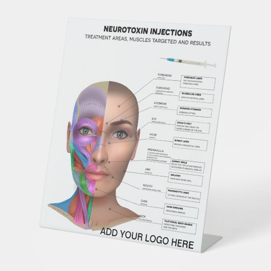 Signe De Table Points d'injection de neurotoxine (Recto)