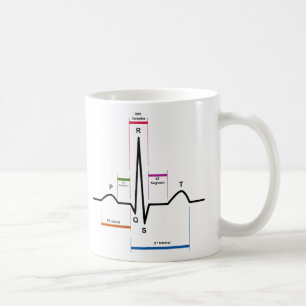 Sinus Rhythm in een ECG-elektrocardiogram diagram Koffiemok