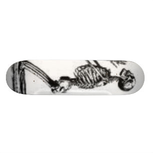 Skateboard squelette