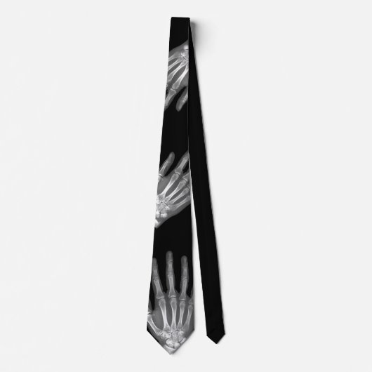 Skeleton Hand X-Ray Mannen Stropdas (Voorkant)