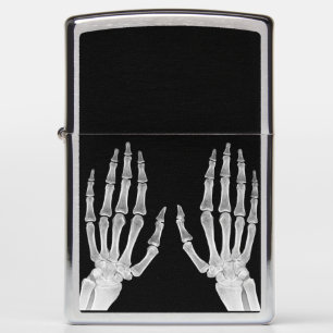 Skeleton Hands Xray Afbeelding Foto van menselijke