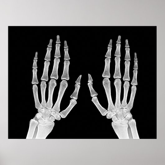 Skeleton Hands Xray Afbeelding Foto van menselijke Poster (Voorkant)