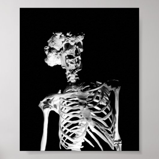 Skeleton Poster (Voorkant)