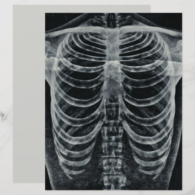 Skeleton Xray Rib kooi  zwart wit gothisch (Voorkant / Achterkant)