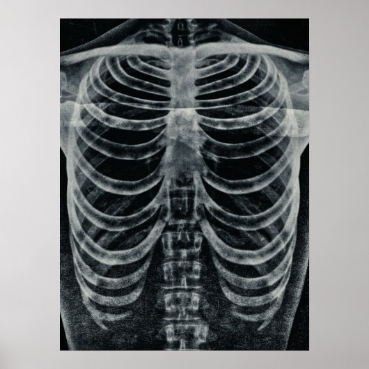 Skeleton Xray Rib kooi zwart wit gothisch Poster (Voorkant)