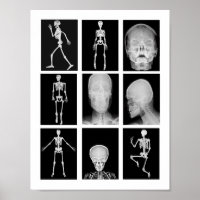 skeletspieren Huid- en onderhuidaandoeningen