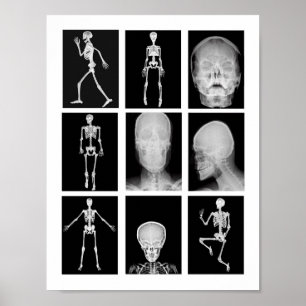 skeletspieren Huid- en onderhuidaandoeningen Poster