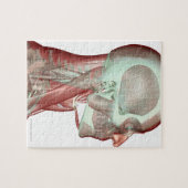 Skeletspierstelsel- en bindweefselaandoeningen legpuzzel (Horizontaal)