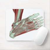 Skeletspierstelsel- en bindweefselaandoeningen muismat (Met muis)