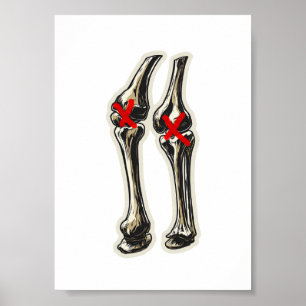 Slechte knieën – Grappige skelet knie illustratie Poster