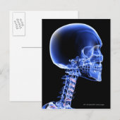 Sluit de röntgenfoto van de botten in de nek briefkaart (Voorkant / Achterkant)