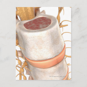 Sluit een ongewervelde schijf in de wervelkolom briefkaart