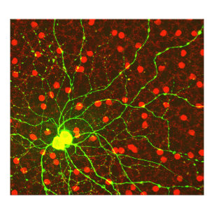 Sluit Uitzicht Retinale Ganglion Cell op Foto Afdruk