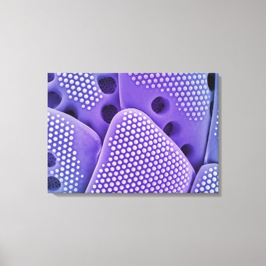 Sluiten van Diatomfrustulae (Mlychenensis) Canvas Afdruk (Voorkant)