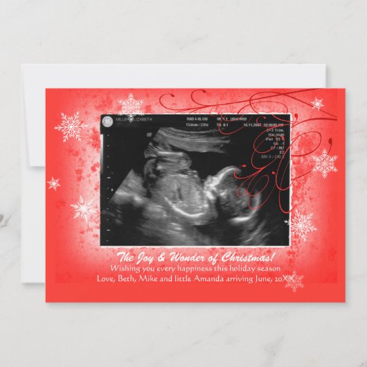 Snowflakes Ultrasound Carte de vacances (Devant)