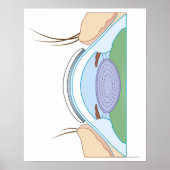Soft Contact Lens Poster (Voorkant)