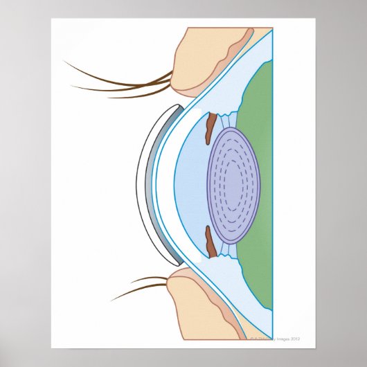 Soft Contact Lens Poster (Voorkant)