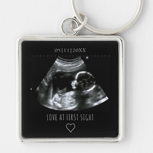 Sonogram Afbeelding Foto Gift Baby Ultrasound Blac Sleutelhanger (Voorkant)