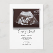 Sonogram Baby Scan Ultrasound Zwangerschap Aankondigingskaart (Voorkant)
