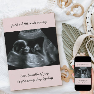 Sonogram Foto Bleek Roze Zwangerschap Aankondiging