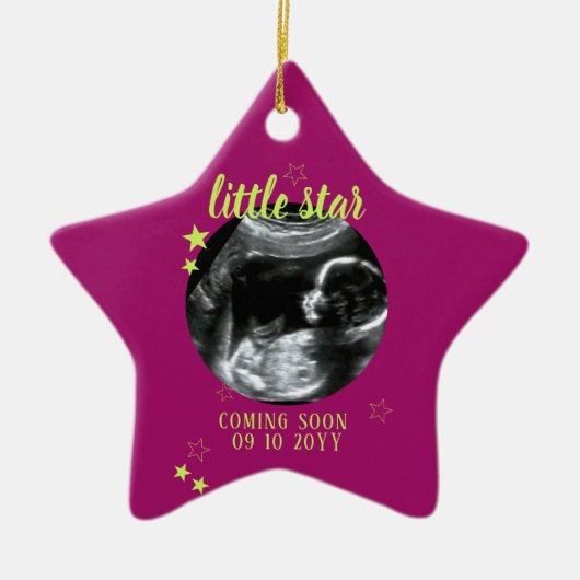 Sonogram Keepomwille Baby Ultrasound Keramisch Ornament (Voorkant)