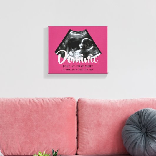 Sonogram Keepsake Baby Echografie Canvas Print (Insitu (Woonkamer))